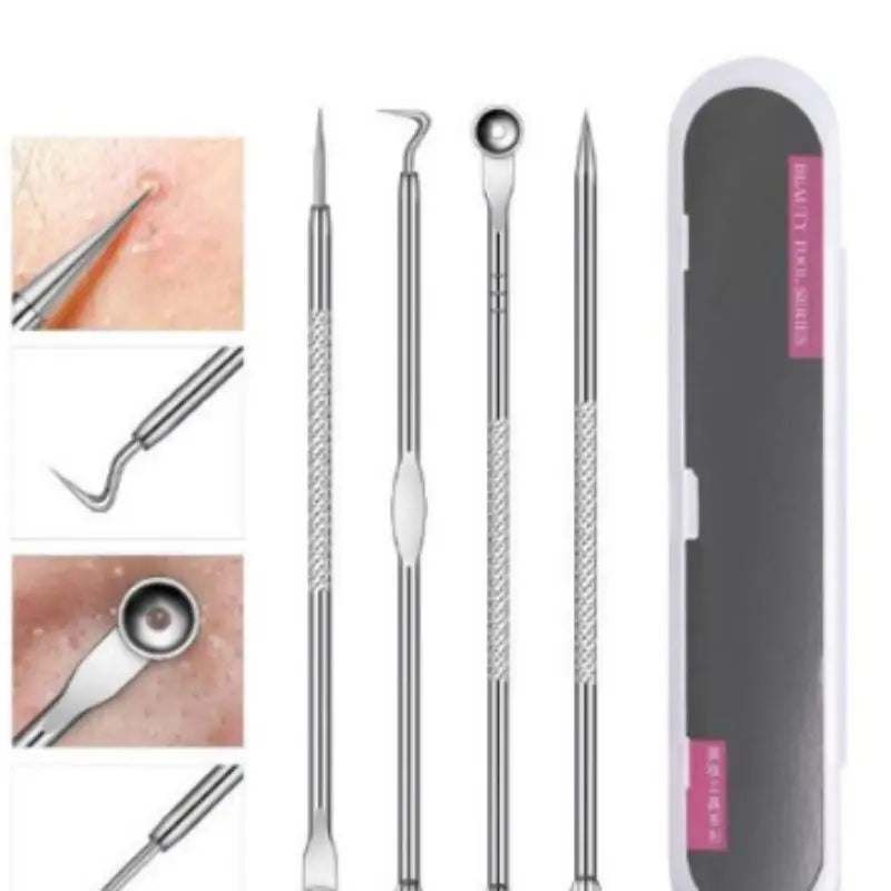 Kit Extrator de Acne Profissional – 4 Peças em Aço Inoxidável